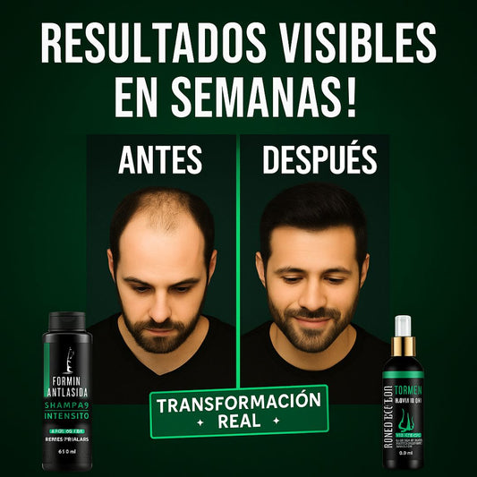 Kit Anticaida y Crecimiento - Combo Minoxidil 7% Shampoo + Tonico