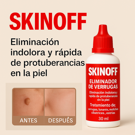 SkinOff